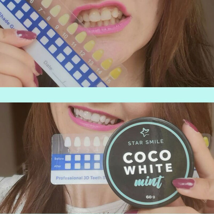 Wybielanie Zębów – CoCo White Mint