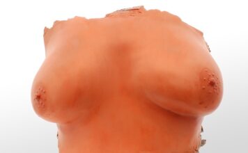 Jak nakładać maskę gipsowa?