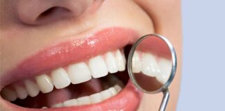 Na czym polega wybielanie zębów