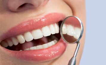 Na czym polega wybielanie zębów