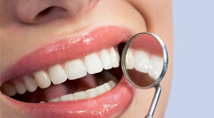 Na czym polega wybielanie zębów